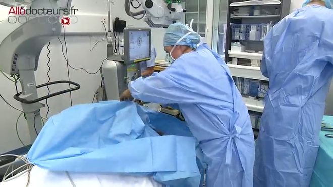 Attention, images d'intervention chirurgicale ! Comment se déroule la chirurgie combinée cataracte-glaucome