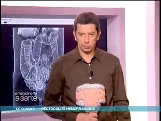 Marina Carrère d'Encausse et Michel Cymes vous montrent ce qui se passe dans le côlon quand il est enflammé