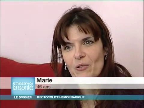 Marie, 46 ans, souffre d'une rectocolite hémorragique depuis 10 ans