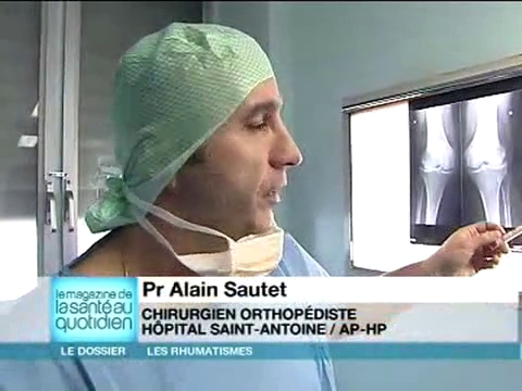 Chirurgie : la prothèse du genou remplace une articulation trop abîmée par l'arthrose.