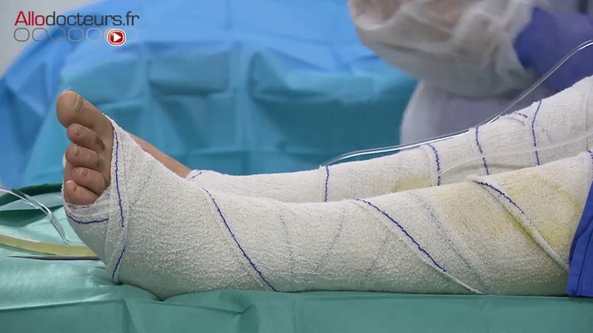 Attention images de chirurgie ! Opération à l'hôpital Percy de Clamart.