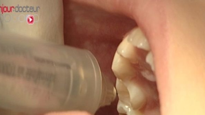 Enfants : ne négligez pas les dents de lait