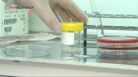 Le principal suspect face aux ulcères est la bactérie helicobacter pylori qui ne se laisse pas démasquer facilement...