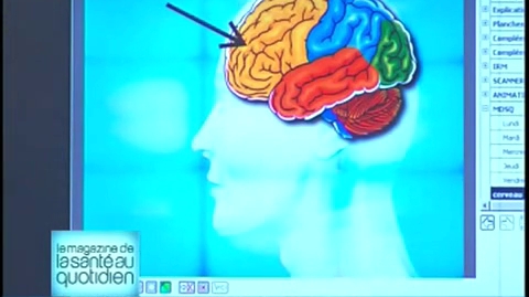 Marina Carrère d’Encausse vous décortique les différentes zones du cerveau en image