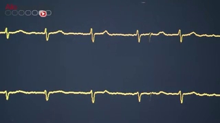 Coeur : un pacemaker miniature