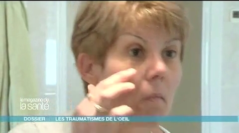 Françoise a perdu la vision de l’œil gauche à la suite d’un accident de voiture, elle vit depuis avec une prothèse