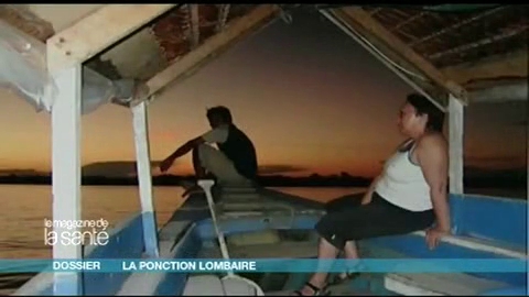 Détecter le syndrome de Guillain-Barré grâce à la ponction lombaire