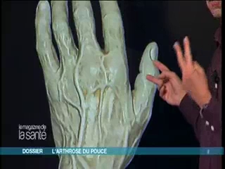 Les explications en image de Michel Cymes