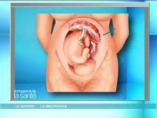 Les explications en images avec Marina Carrère d'Encausse
