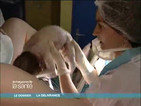 La délivrance du placenta