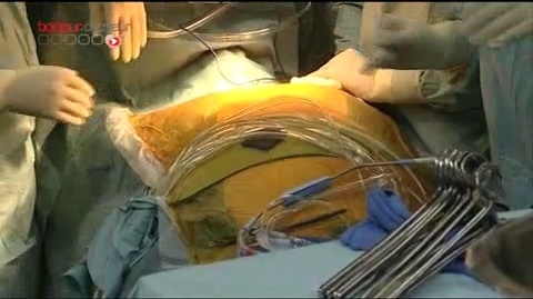 Attention, images de chirurgie : remplacement d'une valve aortique à l'hôpital La Pitié-Salpêtrière