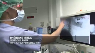 Attention, images de chirurgie ! Traitement chirurgical d'une hernie cervicale