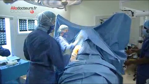 L'opération va consister à raccrocher le tendon détaché.