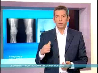 Quelques exemples de scintigraphie décortiqués par Michel Cymes