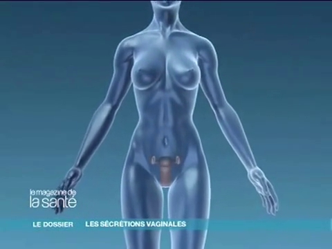 Mycose, vaginose… Tour d’horizon des infections les plus courantes et de leurs traitements