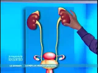 Plus d'explications avec Michel Cymes