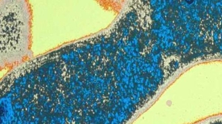 Une infection à la superbactérie résistante NDM-1 détectée en Champagne