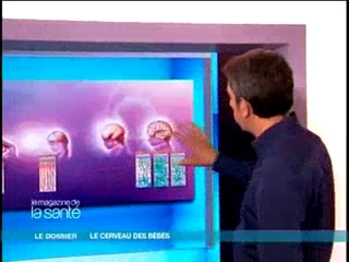 Michel Cymes vous montre l’évolution du cerveau des bébés
