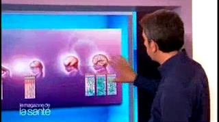 Michel Cymes vous montre l’évolution du cerveau des bébés