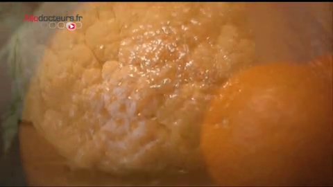 Les crèmes anti-cellulite sont-elles toutes efficaces ?