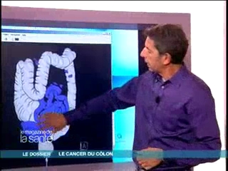 Pour mieux comprendre : l'anatomie du côlon en images