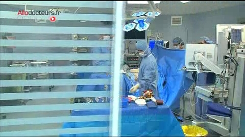 Images de chirurgie : ablation d'une tumeur localisée sur le côlon du patient.