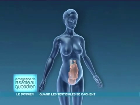 Dans un processus normal, les testicules migrent de l'intérieur du corps aux bourses.