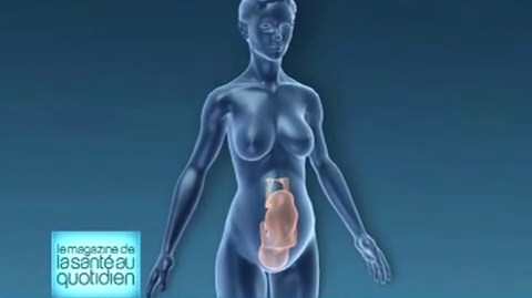 Dans un processus normal, les testicules migrent de l'intérieur du corps aux bourses.