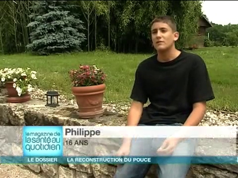 Après l'opération, la rééducation permet de retrouver la souplesse du pouce.