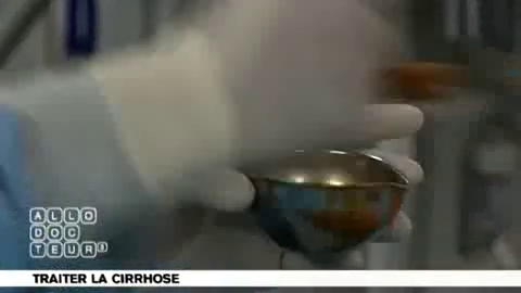 Attention, images d’intervention chirurgicale : le chirurgien détruit la tumeur du foie de l’intérieur.