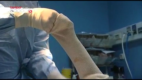 Attention images de chirurgie !