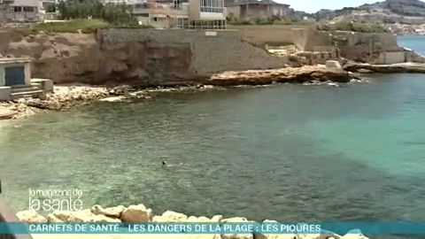 Comment soulager une piqûre d'oursin ?