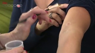 Le maquillage correcteur permet de masquer la dépigmentation due au vitiligo.