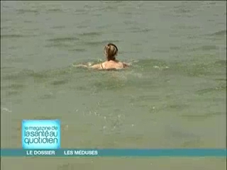 Selon les espèces, les méduses sont recouvertes en partie ou en totalité de cellules très urticantes.