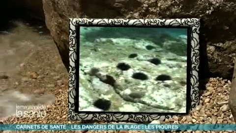 Quels sont les risques liés à une piqûre d’oursin ?