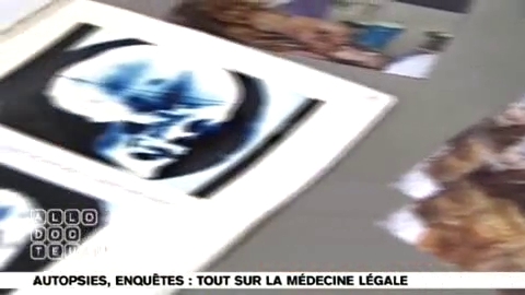 Reconstruction d'un portrait robot avec le Dr Michel Sapanet