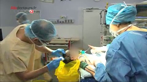 Attention, images d’intervention chirurgicale : le chirurgien recrée des espaces entre les os du crâne du bébé.