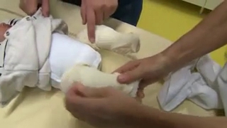 Les plâtres vont permettre de redresser le pied des bébés.