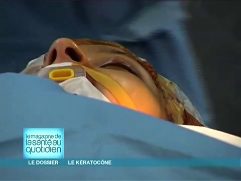 Attention, images d'intervention chirurgicale : la cornée déformée est retirée couche après couche.