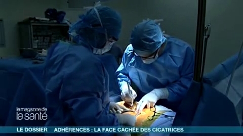 Attention, images d'intervention chirurgicale : le chirurgien enlève les adhérences