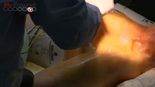 Chirurgie : pose d'un pacemaker