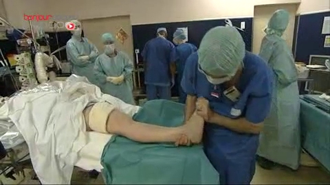 Attention, images de chirurgie orthopédique ! L'arthrodèse bloque définitivement une articulation pour qu'elle ne soit plus source de douleurs et pour la stabiliser.