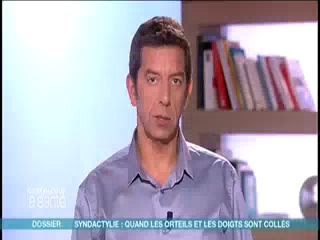Marina Carrère d'Encausse et Michel Cymes expliquent la syndactylie.