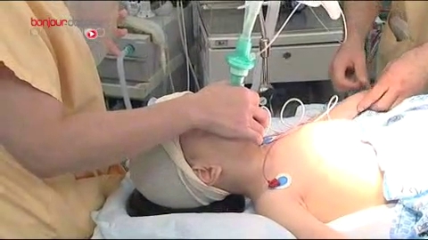 Attention, images d'intervention chirurgicale : une incision en zigzag permet une meilleure évolution de la cicatrice.