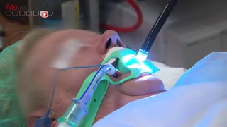 Attention images de chirurgie ! Ablation d'un polype de l'estomac