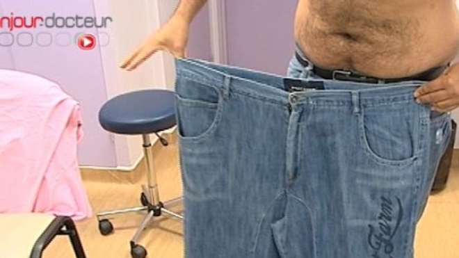 Sleeve gastrectomie, la moins connue des chirurgies de l'obésité