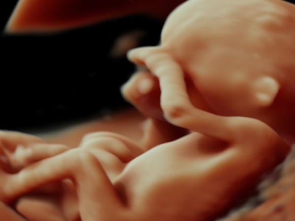La 3D haute définition in utero