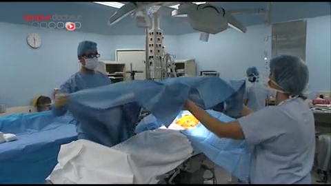 Comment s'effectue la pose de la sonde ? Attention, images de chirurgie !
