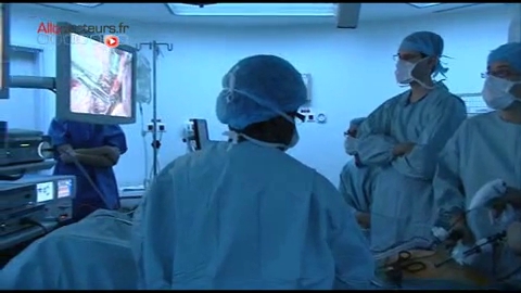 Attention il s’agit d'images de chirurgie.