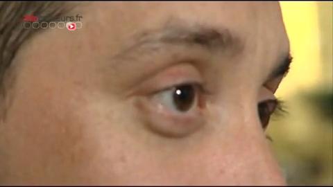 Carlos souffre d'une blépharite chronique depuis 2003.